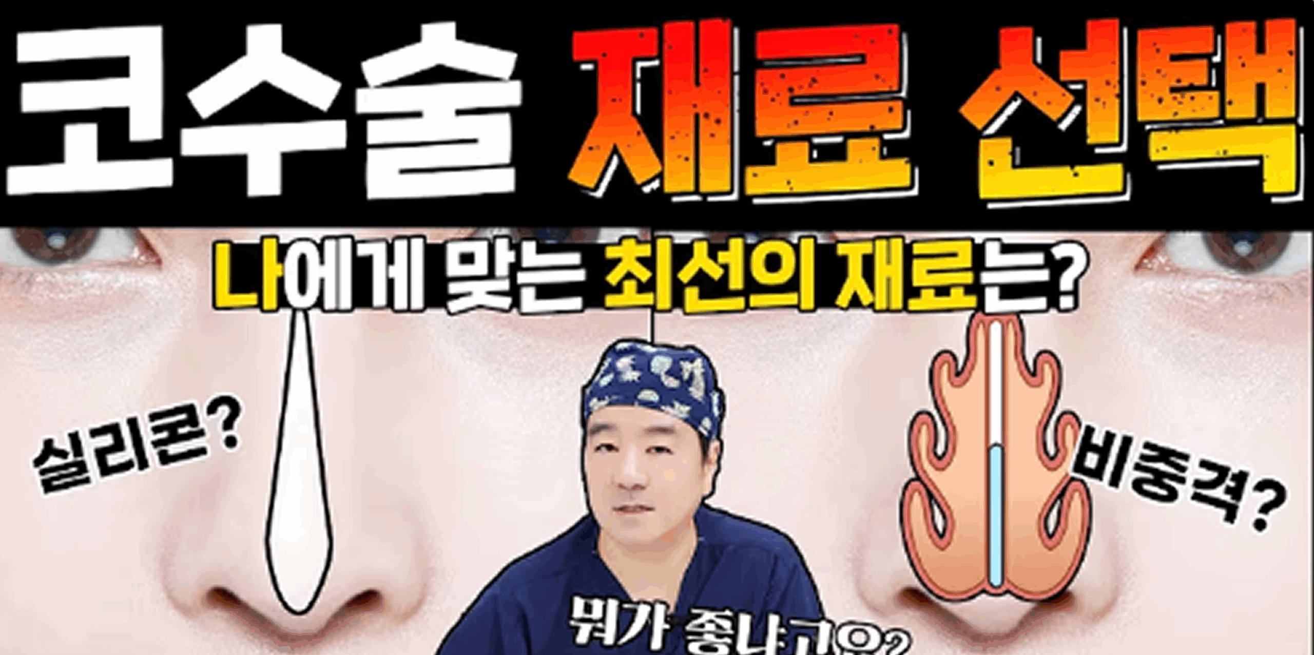 코수술 재료도 상황에 맞춰서?!😲코수술 재료 선택의 비밀!!🤩